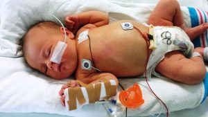 newborn-617414-300x169.jpg